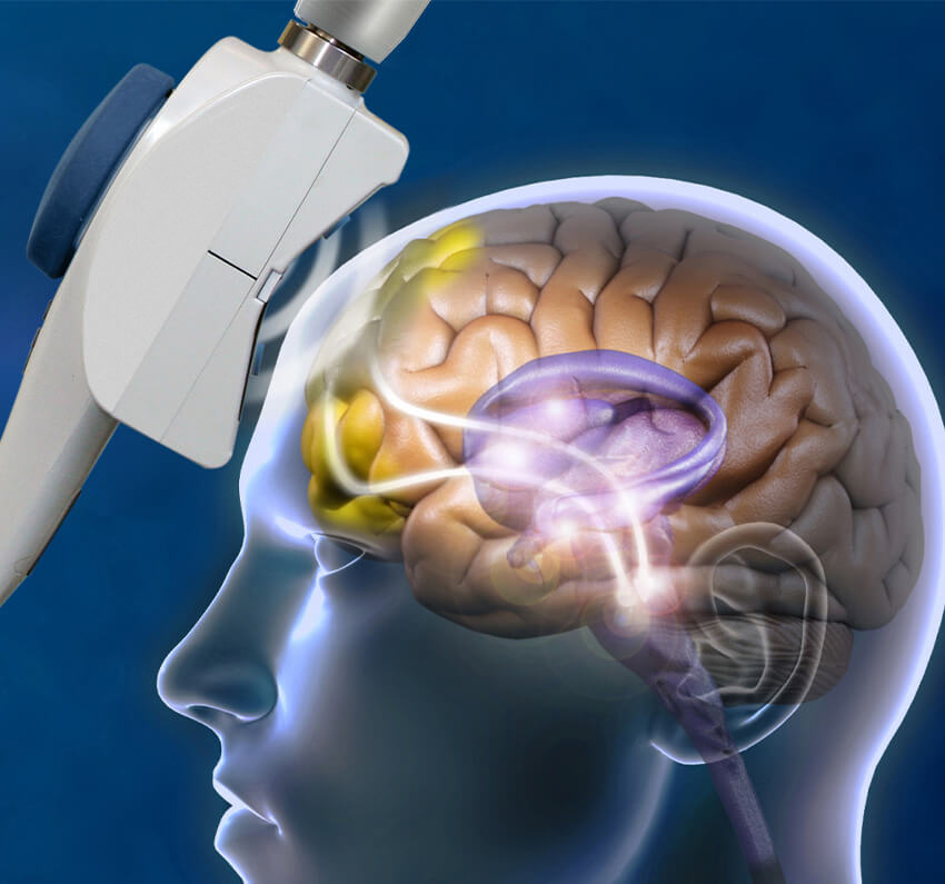 tms therapy tms specialist tms specialist frisco tms therapy near me tms treatment for depression Benefits of TMS Therapy